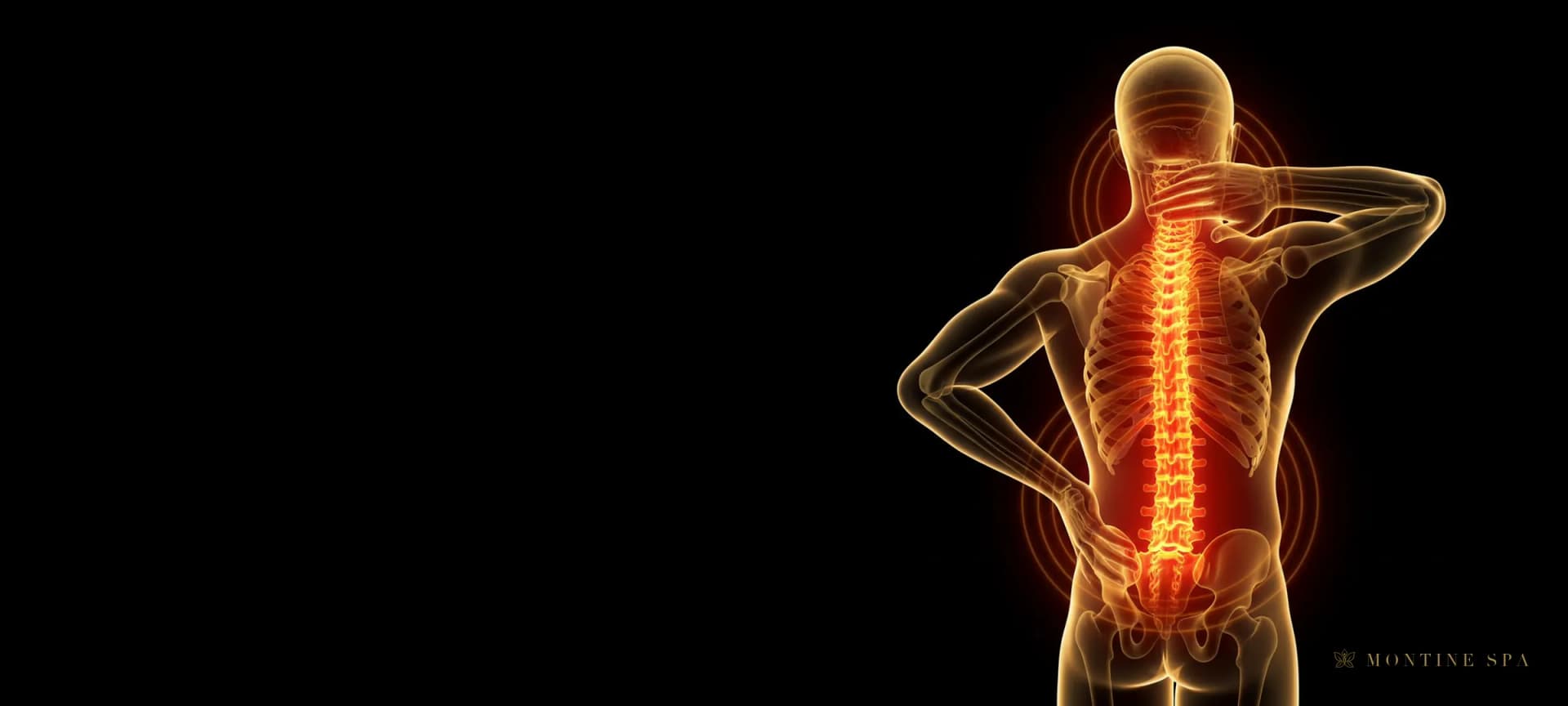 Illustration of a spine with lower back and neck pain highlighted